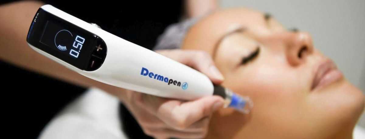 Skin treatment with the Dermapen 4 device (Australia)